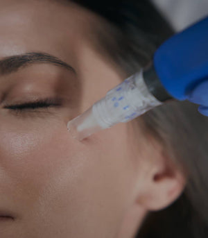 What Is Microneedling? An Esthetician's Guide to Collagen Induction Therapy